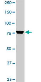 PIK3R1 monoclonal antibody (M01), clone 3A10