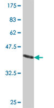 PHKA1 polyclonal antibody (A01)