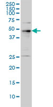 PHF1 monoclonal antibody (M01), clone 2D3