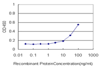 PGM3 monoclonal antibody (M01), clone 1E2-1B12