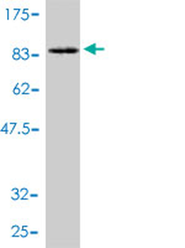 PGM1 polyclonal antibody (A01)