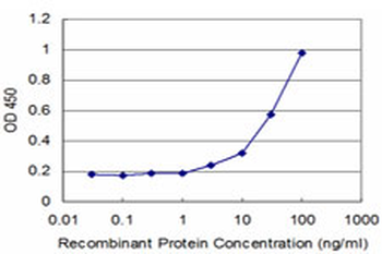 PFKFB3 monoclonal antibody (M08), clone 3F3