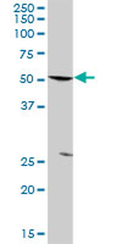 PFKFB3 purified MaxPab rabbit polyclonal antibody (D01P)
