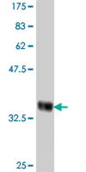SLC26A4 polyclonal antibody (A01)