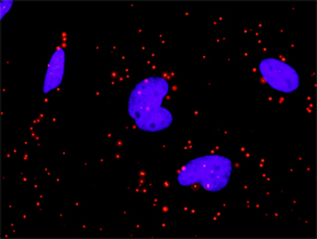 PDGFRA purified MaxPab rabbit polyclonal antibody (D01P)