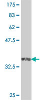 PDE7A polyclonal antibody (A01)