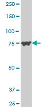 PCSK6 polyclonal antibody (A01)