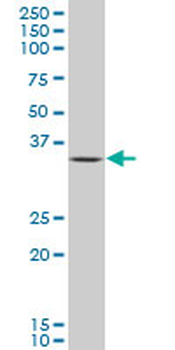 OTX1 polyclonal antibody (A01)