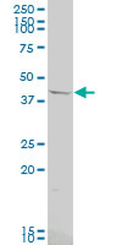 OPRK1 polyclonal antibody (A01)