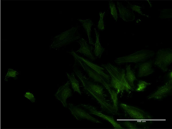 ODF2 monoclonal antibody (M01), clone 1A1