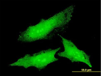 ODC1 monoclonal antibody (M01), clone 2G5