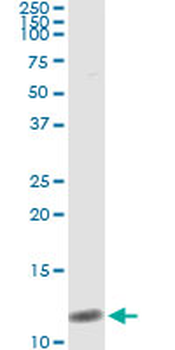 NPPB monoclonal antibody (M01), clone 2D11