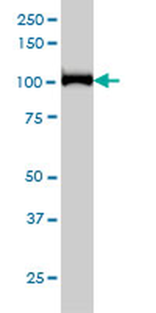 CNOT3 monoclonal antibody (M01), clone 4B8