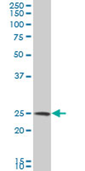 NQO2 polyclonal antibody (A01)