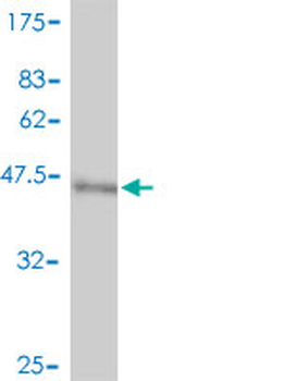 NME3 polyclonal antibody (A01)