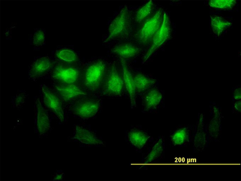 NME2 monoclonal antibody (M08), clone 1F2