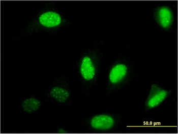 NFIB monoclonal antibody (M08), clone 2D6