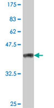 NFATC1 polyclonal antibody (A01)