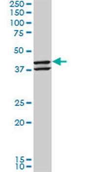 NEU2 monoclonal antibody (M03), clone 3B9