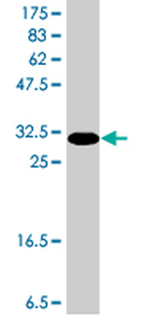 NELL1 polyclonal antibody (A01)