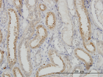 NDUFS3 monoclonal antibody (M02), clone 1D6