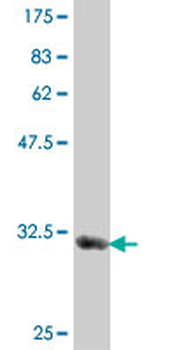 MYL1 polyclonal antibody (A01)