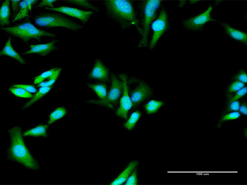 MX1 purified MaxPab rabbit polyclonal antibody (D01P)