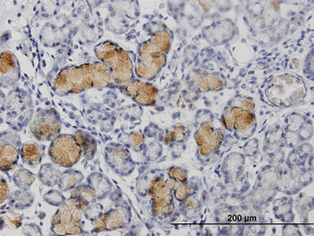 MMP1 MaxPab rabbit polyclonal antibody (D01)