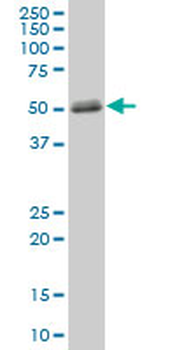 MMP1 purified MaxPab mouse polyclonal antibody (B01P)