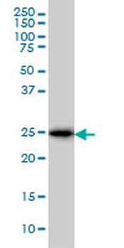 CD99 monoclonal antibody (M01), clone 3A10