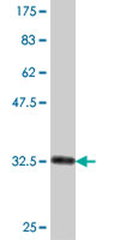 MGST3 polyclonal antibody (A01)