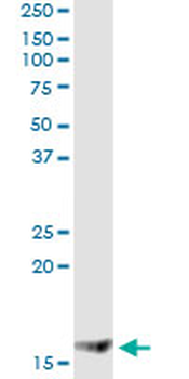MGST2 monoclonal antibody (M01A), clone 1D11