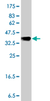 MGAT5 polyclonal antibody (A01)