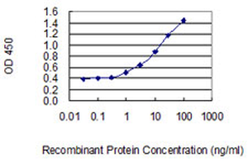 MGAT2 monoclonal antibody (M01), clone 6G5