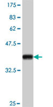 MEFV polyclonal antibody (A01)