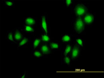 MDM4 purified MaxPab mouse polyclonal antibody (B01P)