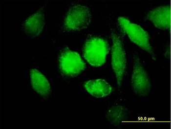 MAOB purified MaxPab mouse polyclonal antibody (B01P)