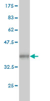 MAN2A1 monoclonal antibody (M01), clone 1G9