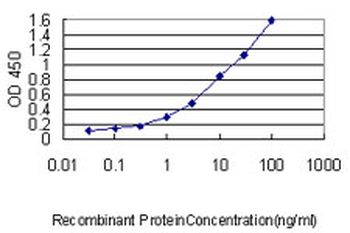 MAD2L1 monoclonal antibody (M01), clone 2E2-1D6