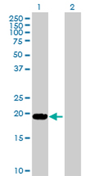 LTA purified MaxPab rabbit polyclonal antibody (D01P)