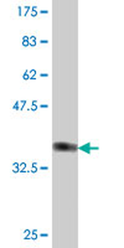 LMO7 polyclonal antibody (A01)