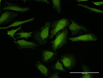 LGALS1 purified MaxPab rabbit polyclonal antibody (D01P)