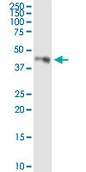 LDHC purified MaxPab rabbit polyclonal antibody (D01P)
