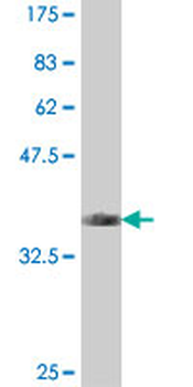 LAMA5 polyclonal antibody (A01)