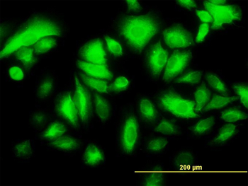 KRT17 monoclonal antibody (M01), clone 2D4-1G9