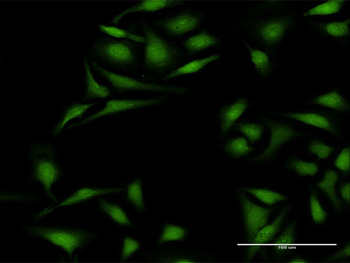 KRT12 purified MaxPab rabbit polyclonal antibody (D01P)