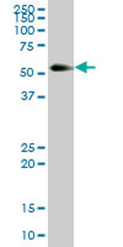 KNG1 purified MaxPab mouse polyclonal antibody (B01P)