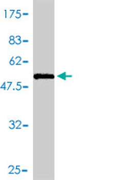 KHK polyclonal antibody (A01)