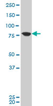 KCNN3 polyclonal antibody (A01)