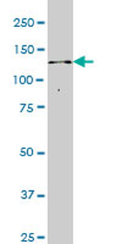 ITPKB monoclonal antibody (M01), clone 2F8